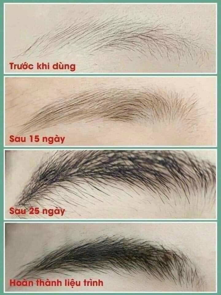 COMBO SERUM DÀI MI KÍCH MỌC MI DÀI VÀ DÀY
