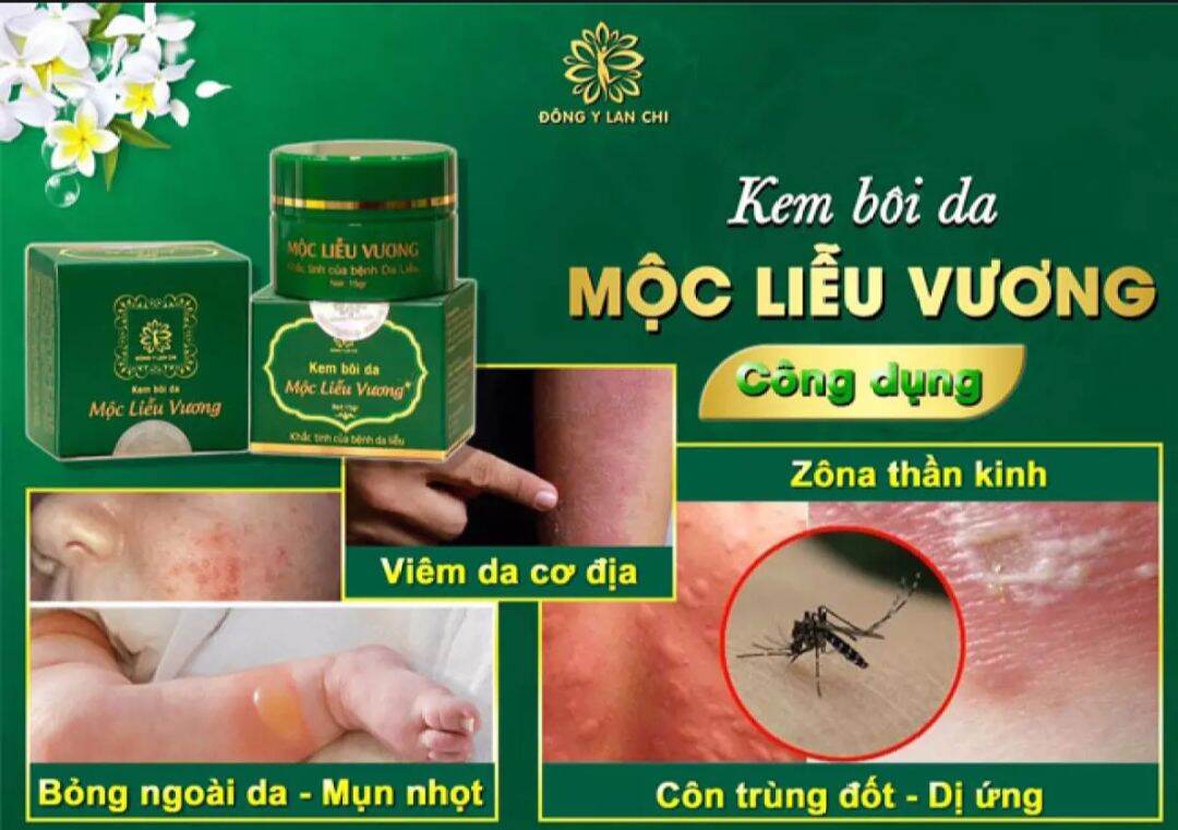 Kem bôi da mộc liễu vương đông y lan chi