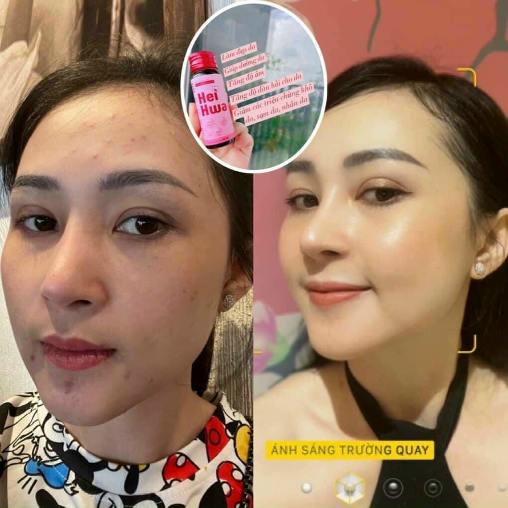 Collagen Tripeptide Hei Hwa siêu hấp thu ( Hộp 10 chai 30ml)