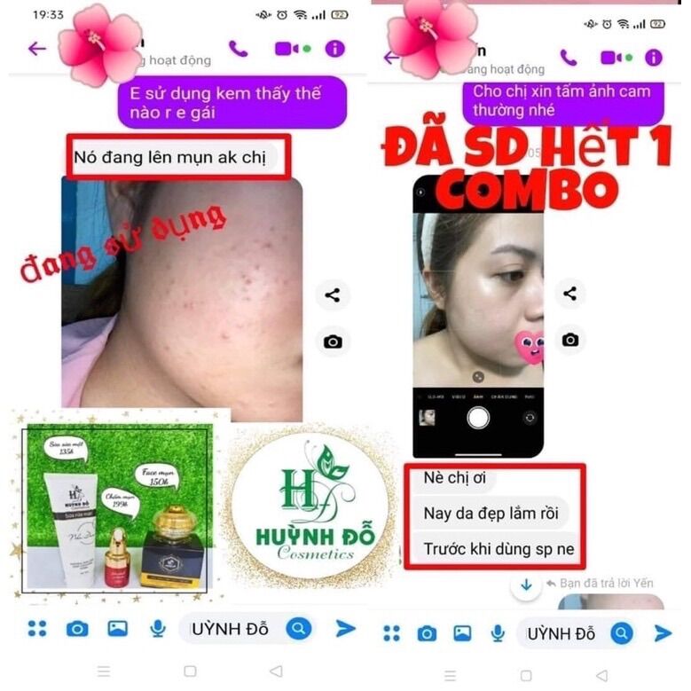 KEM CHUYÊN MỤN HUỲNH ĐỖ