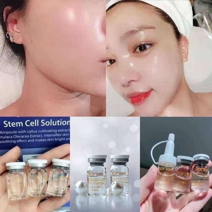 Tế Bào Gốc phục hồi da Ronas