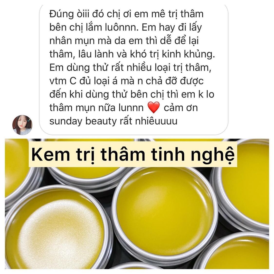 Kem thâm handmade Sunday Beauty