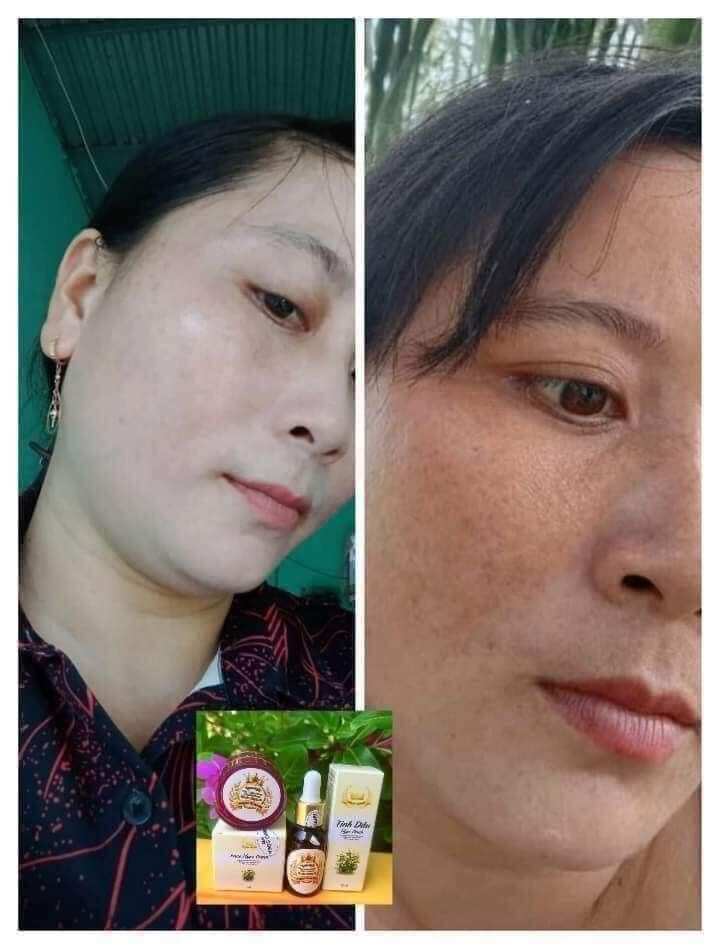 Bộ đôi Kem Face Ngọc Oanh
