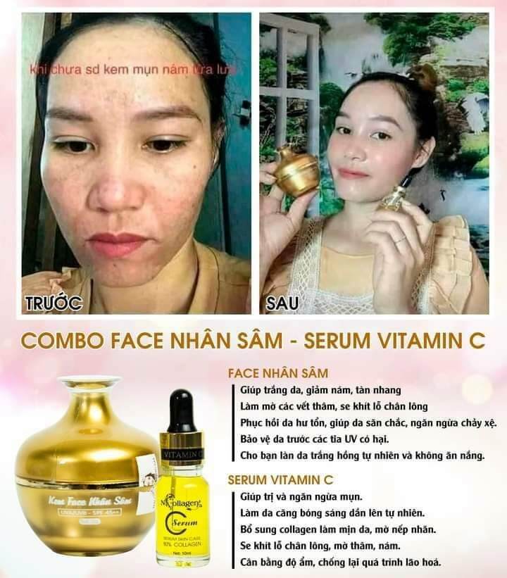 SERUM VITAMIN C NCOLLAGEN ( CHỨA 80% COLLAGEN TƯƠI)