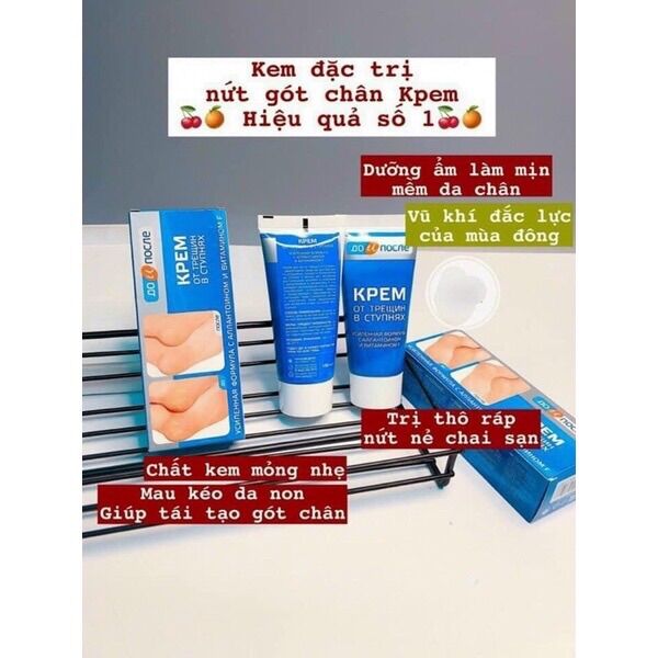 Kem bôi nứt gót chân Nga Kpem 50ml