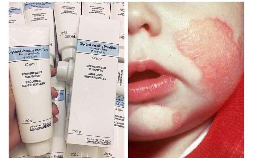 Kem nẻ dexeryl 250g chuyên đổ quầy