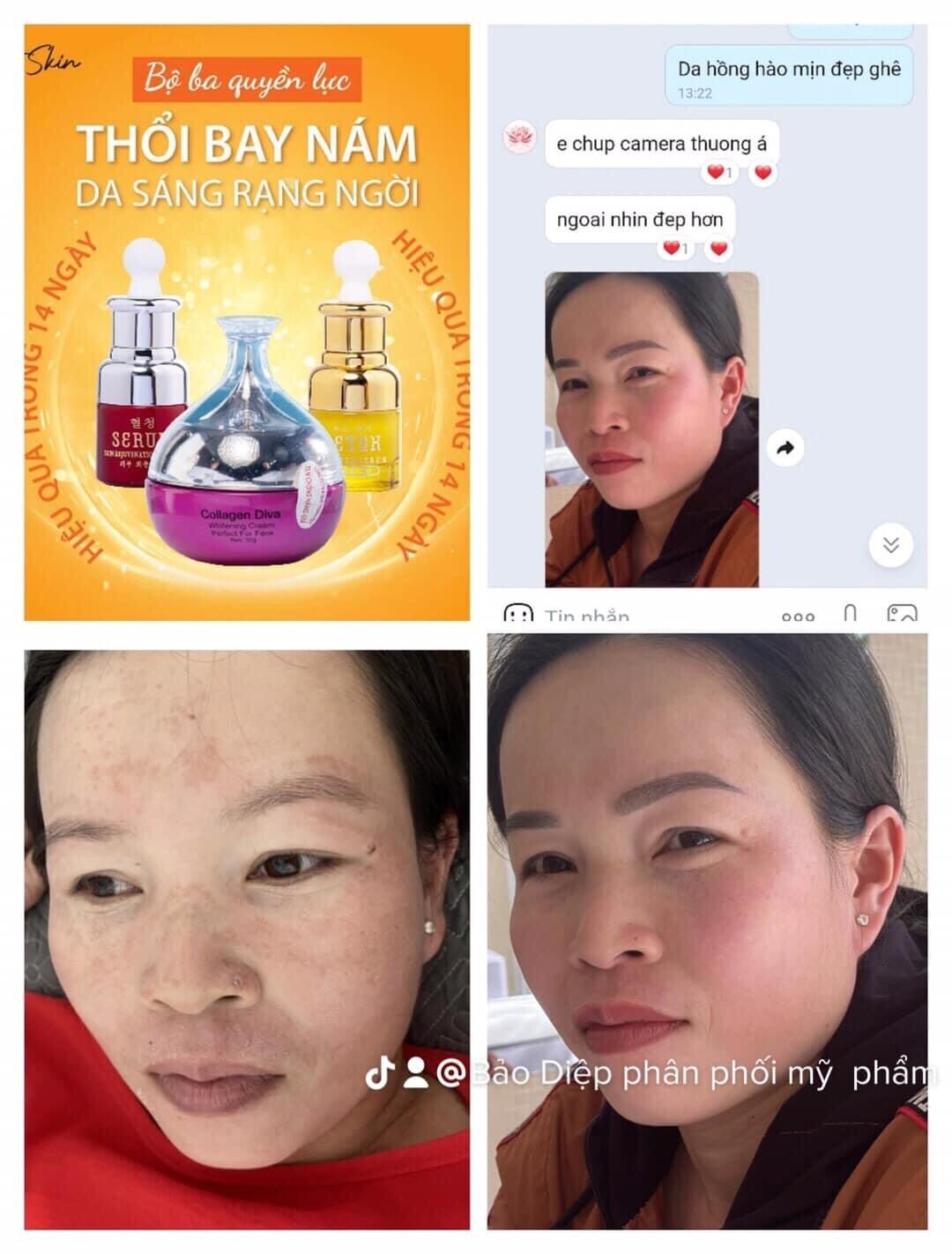 Combo 5 chai serum vitamin C trắng da ( bị mất vỏ xả lỗ )