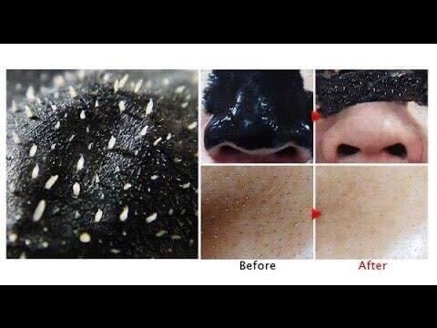 Mặt nạ lột mụn Bùn non Shiseido