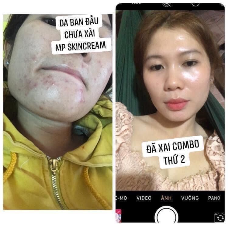 Combo SERUM (lớn) + FACE LINH CHI
