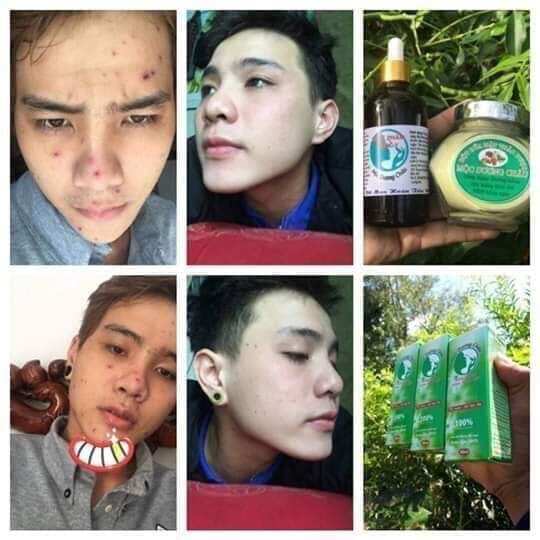 Dược Phẩm Đông Y Mộc Dương Châu 30ml