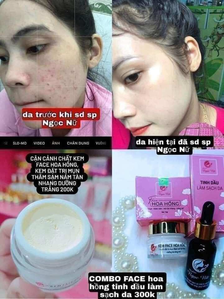 combo face hoa hồng ngọc nữ