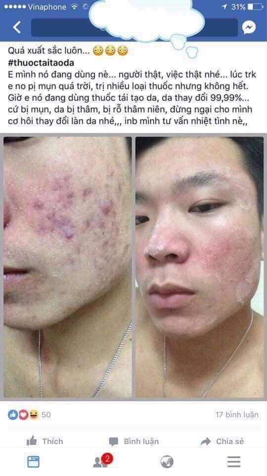 Tinh chất tái tạo loha 50ml (tặng tonner)