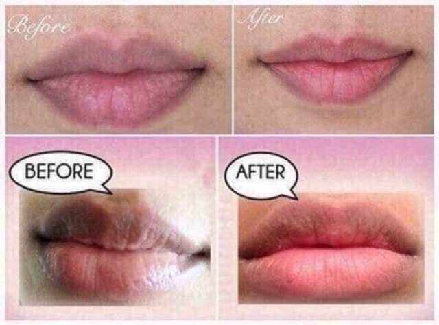 Son Dưỡng Giảm Thâm Môi Lip Care Thái Lan