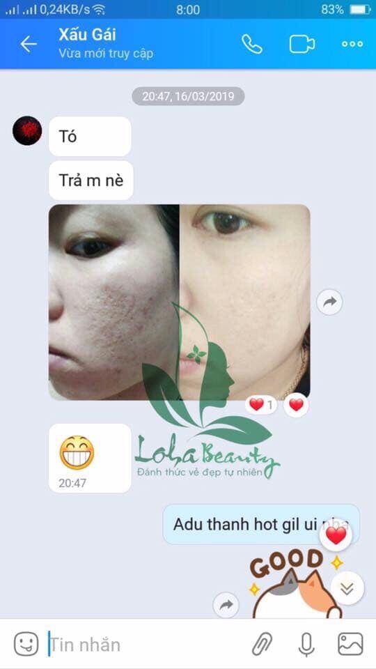 Tinh chất tái tạo loha 50ml (tặng tonner)