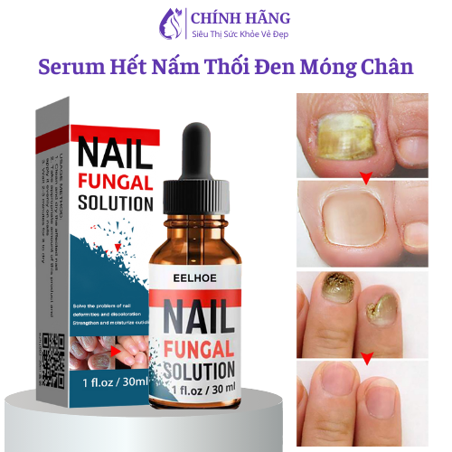 Serum Đánh Bay Nấm Móng Tay Chân Tái Tạo Móng Chắc Khỏe Sáng Bóng 30ml