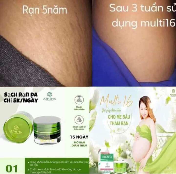 KEM MULTI 16 HẾT SẠCH RẠN DA HỘP 20G