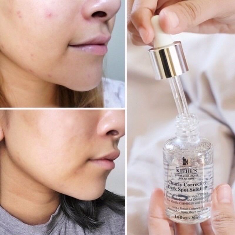 [HCM][BILL US] Serum làm sáng mờ thâm Kiehls Clearly Corrective Dark Spot Solution