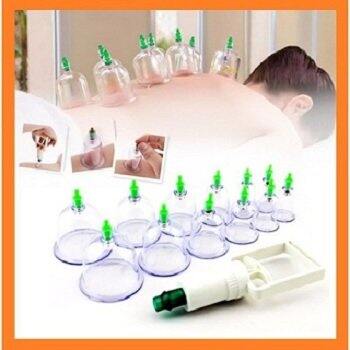 Bộ giác hơi 12 món không dùng lửa