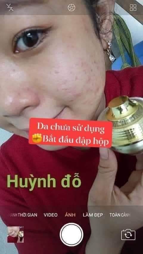 SỈ 2 HỘP FACE MỤN HUỲNH ĐỔ