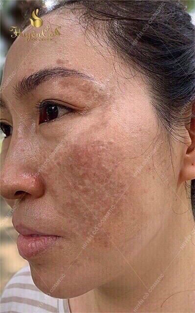 Kem nám tảo lục huyền cò