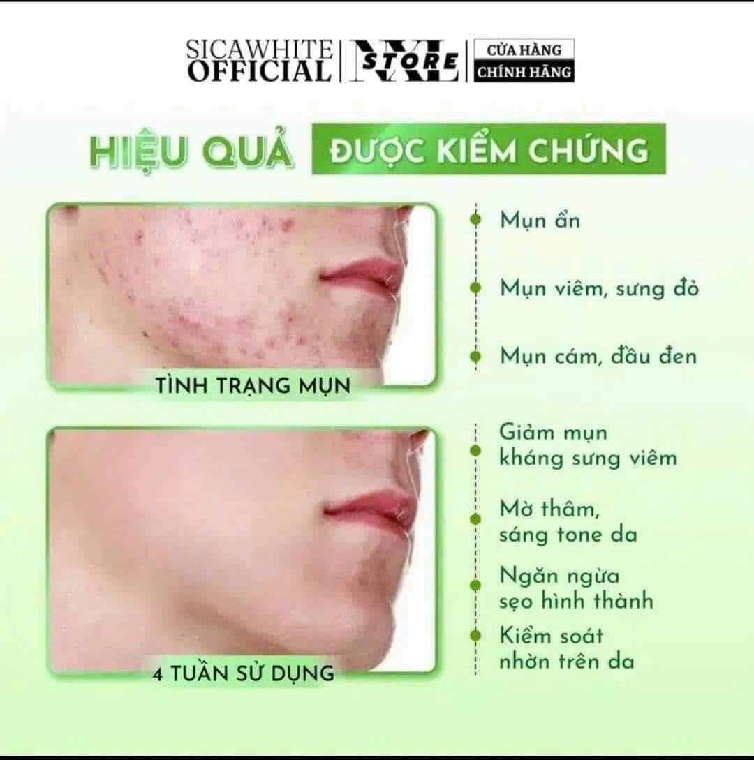 kem mụn thâm sicawhite