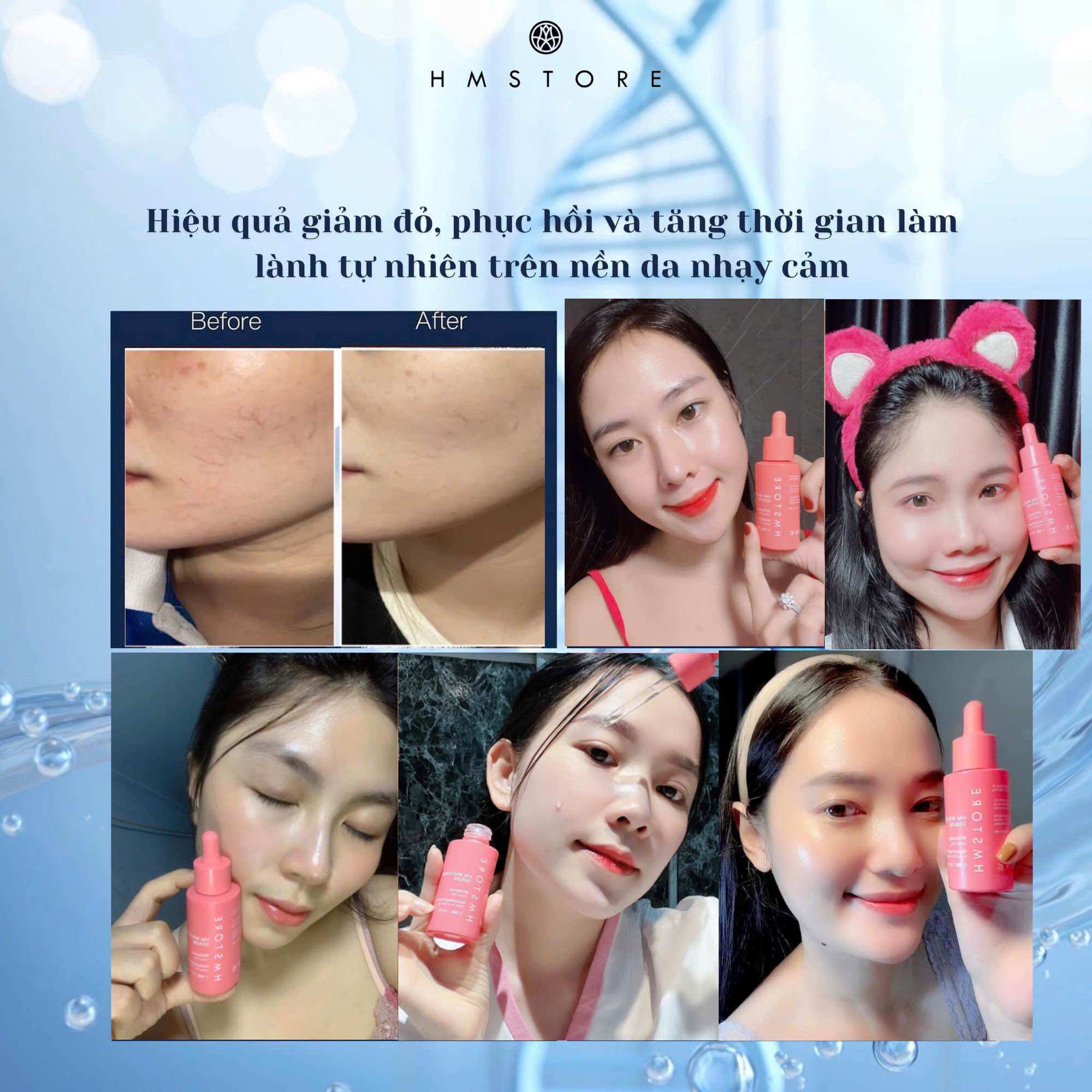 SERUM TRẮNG DA HM STORE MẪU BAO BÌ MỚI 2022