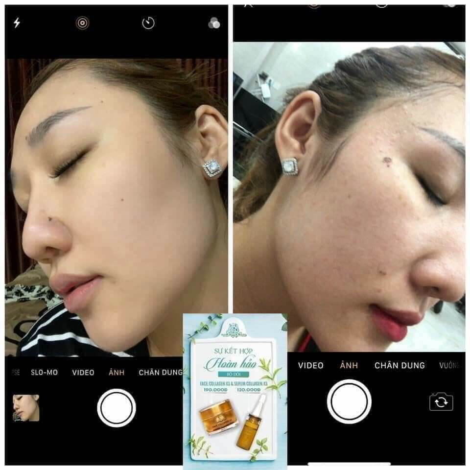 [HCM]KEM FACE COLLAGEN X3 ĐÔNG ANH