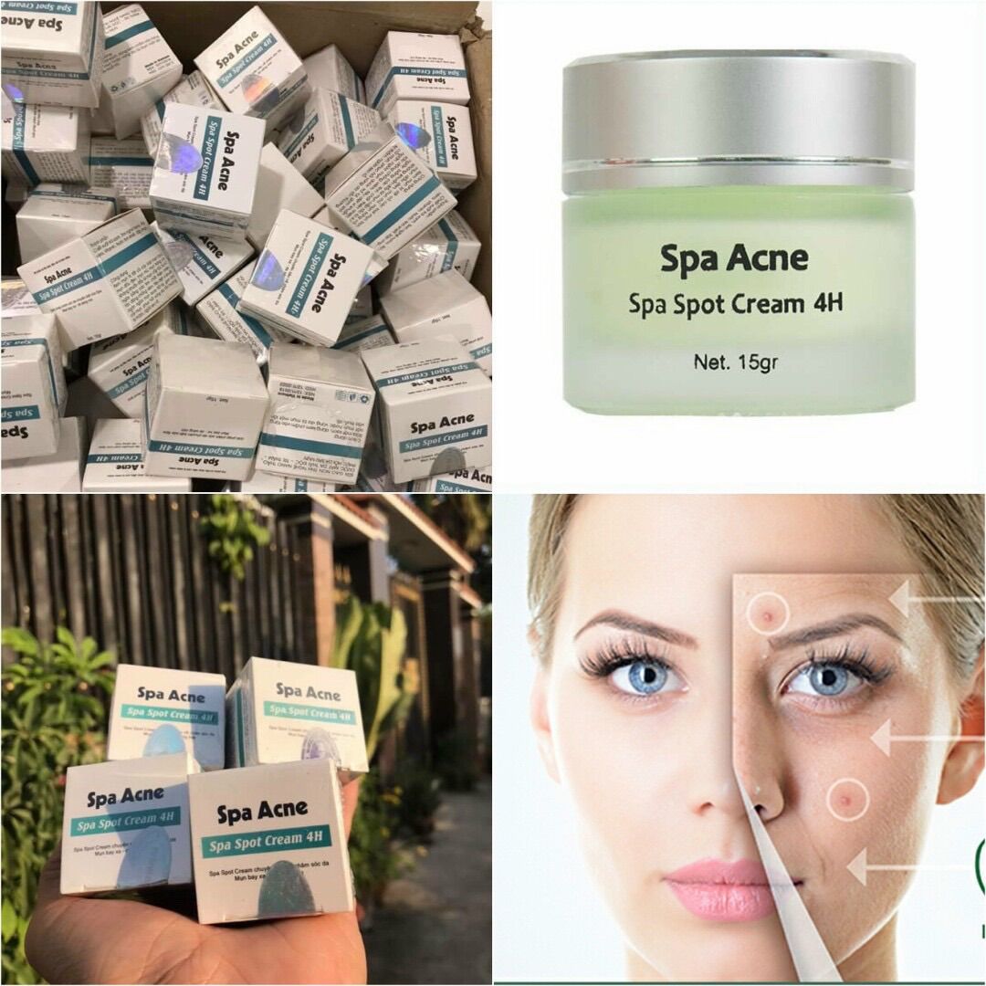 Kem mụn spa acne