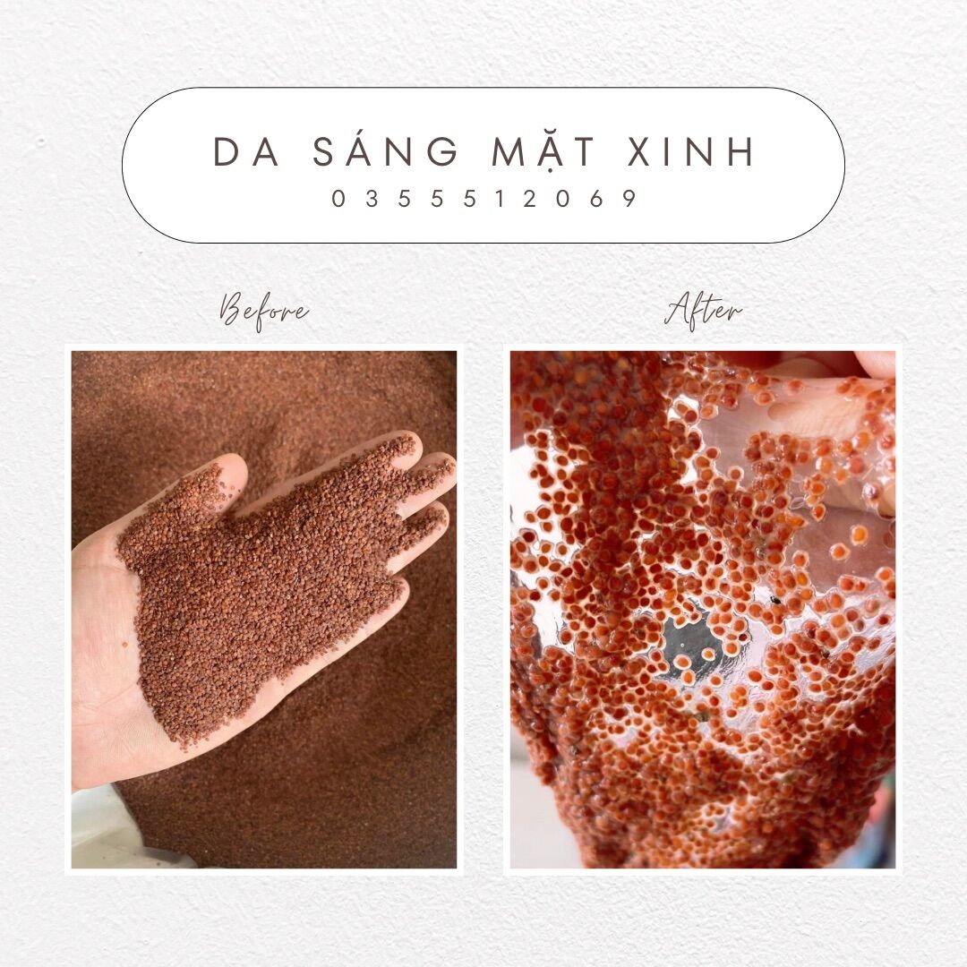 NGŨ HOA HẠT LOẠI TO ( GIẢM MỤN - KIỀM DẦU - GIẢM SƯNG )