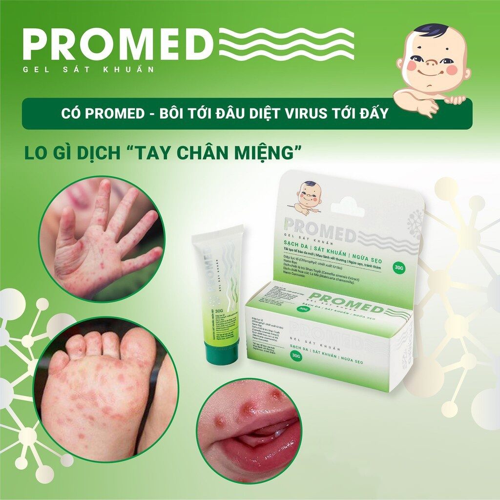 Gel sát khuẩn PROMED (tặng 1 hộp thuốc nhỏ mắt Q-mumasa baby).