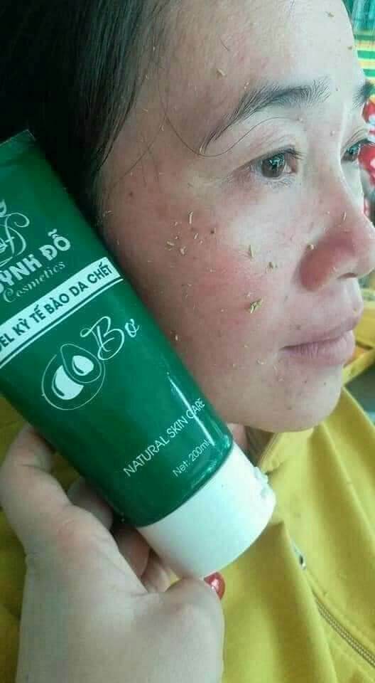 Tẩy tế bào chết bơ .gel kỳ tế bào da chết huỳnh đỗ
