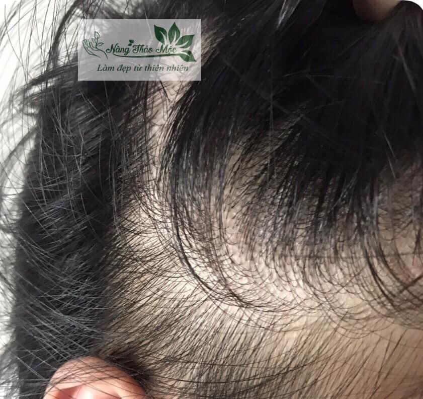 Tinh dầu bưởi nguyên chất 20ml