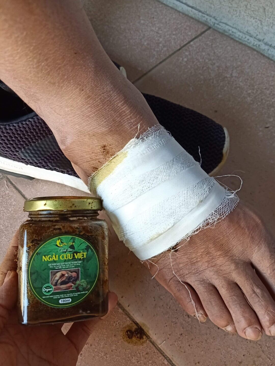 TINH DẦU NGẢI CỨU VIỆT 200 ml
