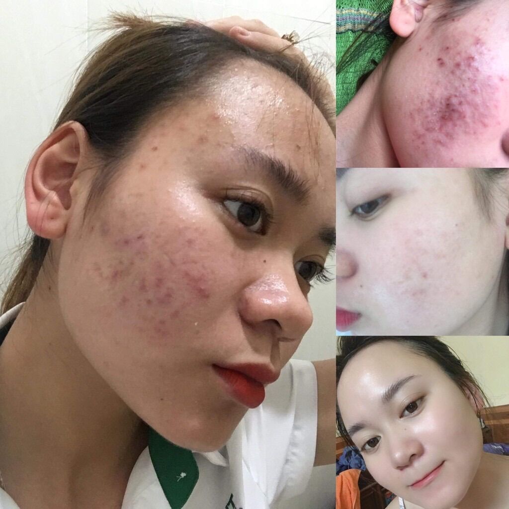 Mặt Nạ Dưỡng Da Ngọc Sâm Dạng Pha Sẵn