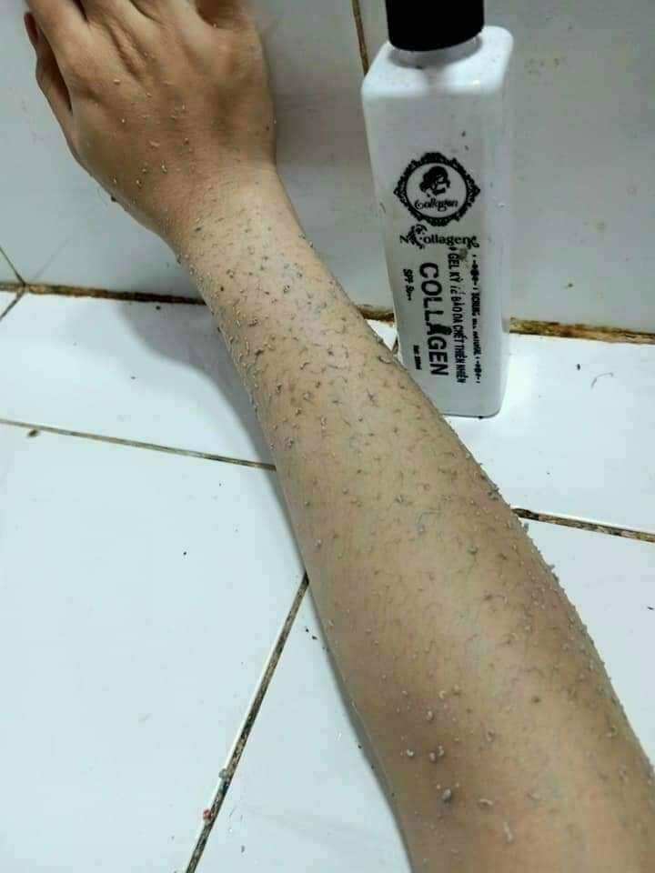 GEL KÌ TẾ BÀO NCOLLAGEN
