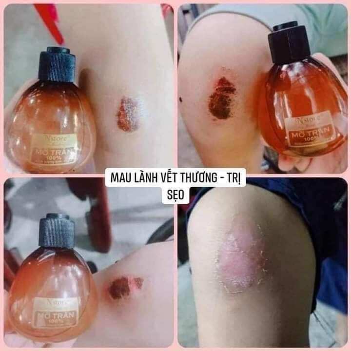mở trăng triệt lông NSTORE