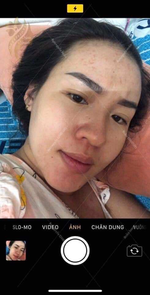 (1 chai)Tinh chất Tái tạo da hồng sâm MC_SKIN (chínhhãng).