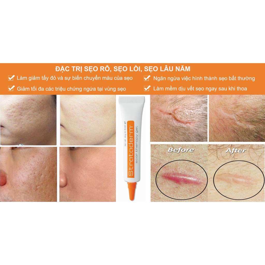 Gel mờ sẹo strataderm 5gr Thụy Sỹ
