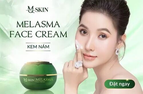 Kem Nám Melasma MQ SKIN 30g