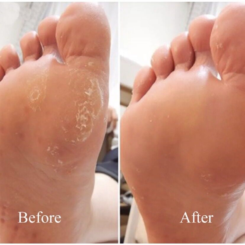 Bộ Lấy Khoé Móng, Làm Sạch Da