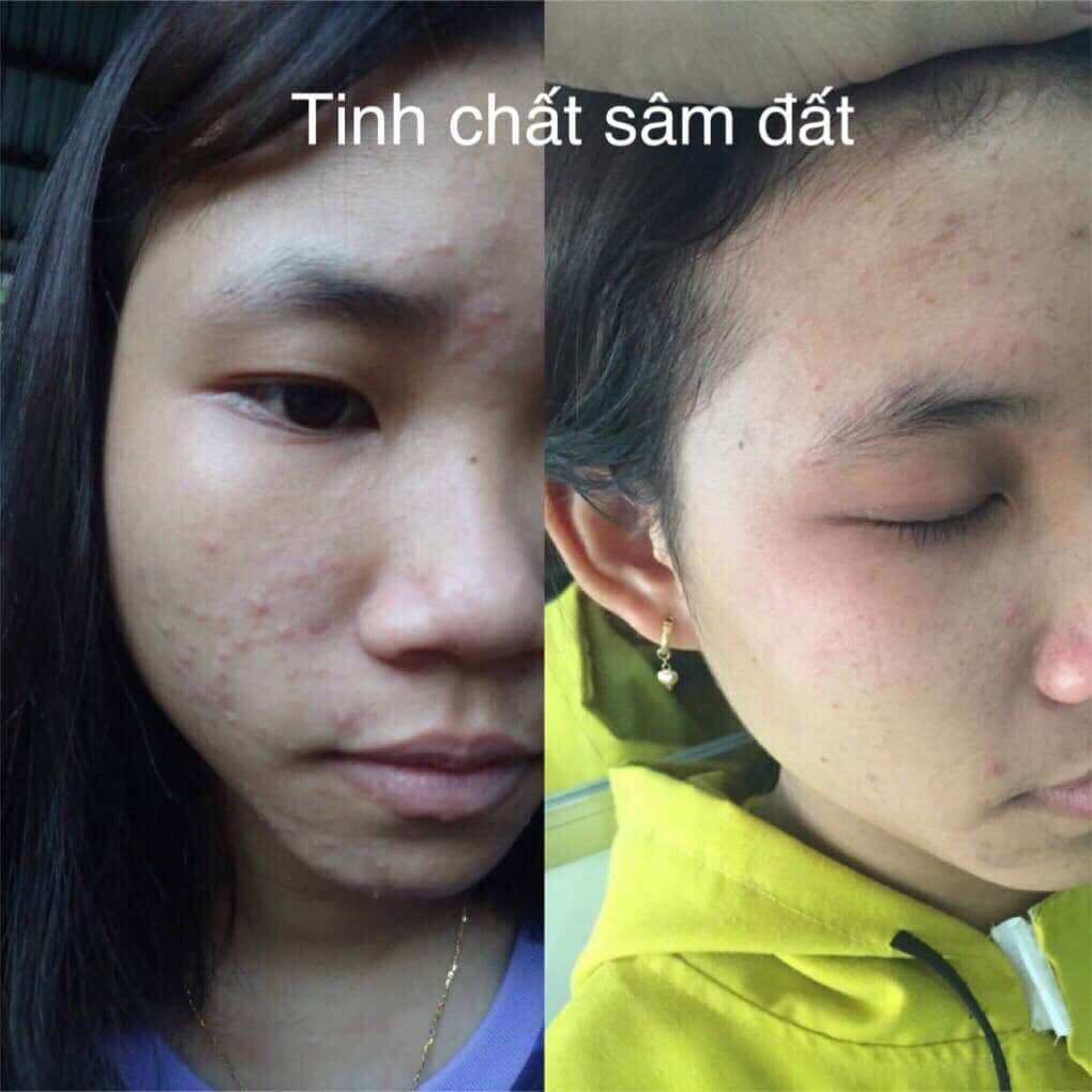 Tinh Chất Sâm Đất DR CELL 50ml