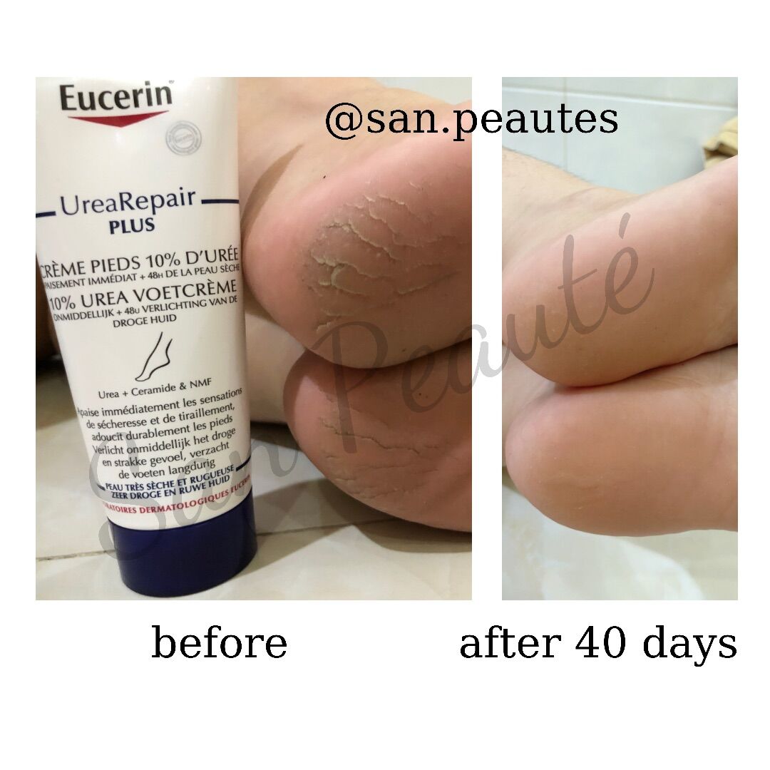 [HCM]Kem giảm nứt gót chân Eucerin 10% Urea Repair Plus