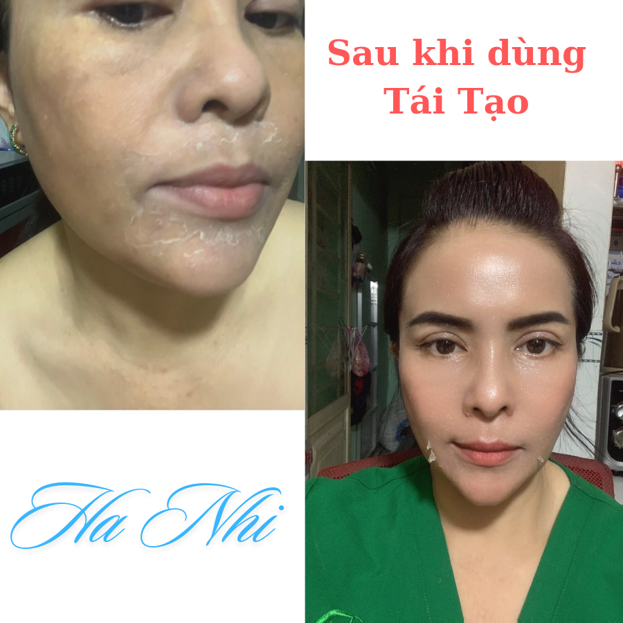 COMBO: Tái Tạo VIP