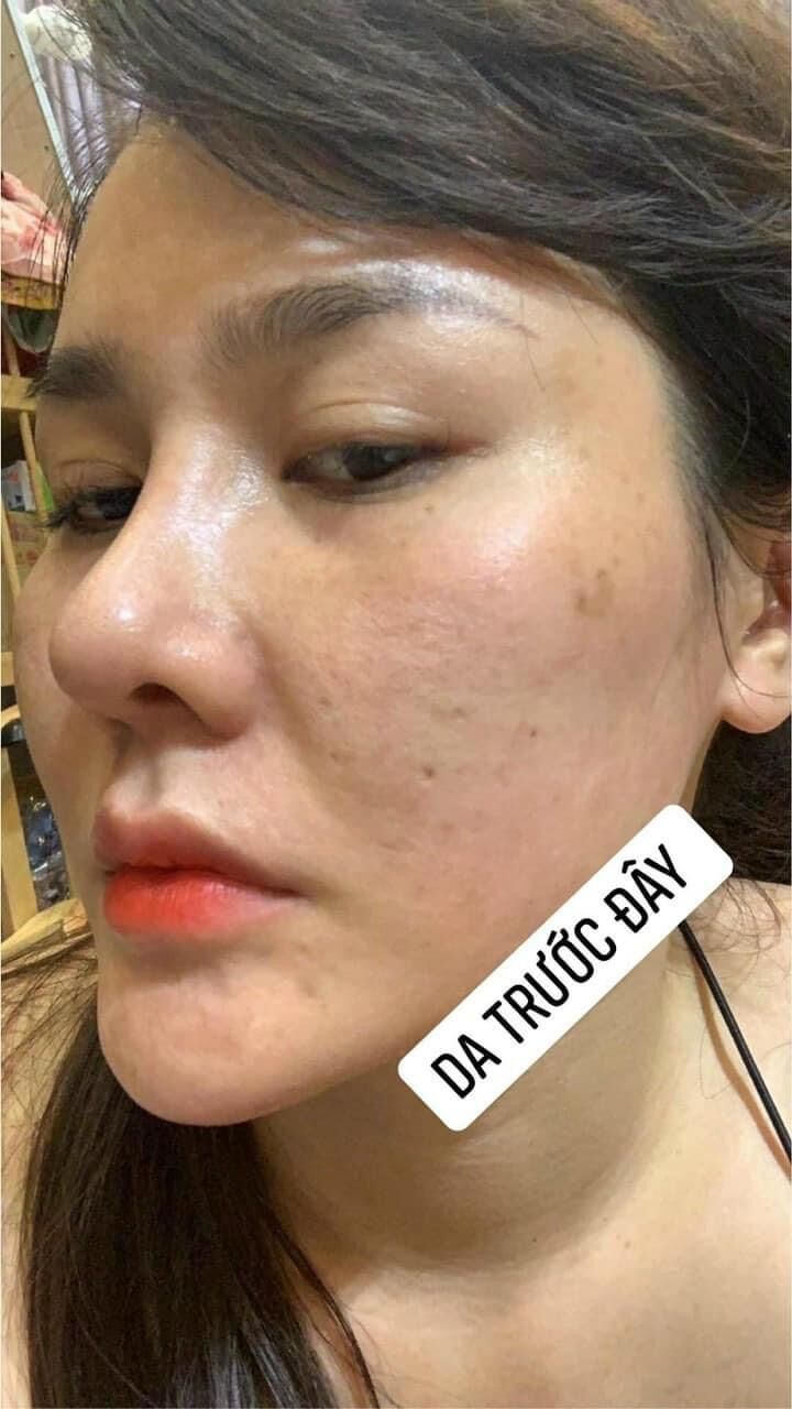 TÁI TẠO DA HỒNG SÂM + BỘT RỬA MẶT <HÀNG CHÍNH HÃNG CTY>
