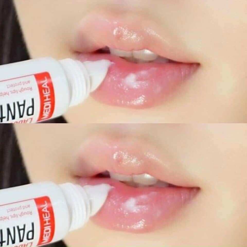 Son dưỡng giảm thâm môi Mediheal