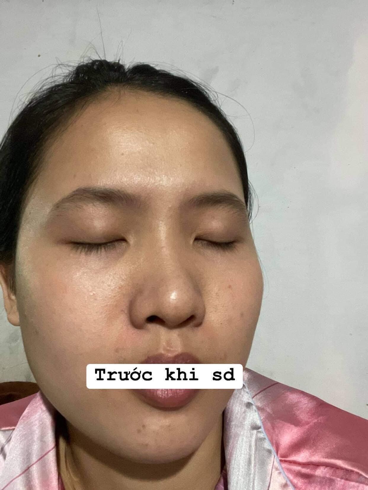 KEM FACE YẾN MẠCH TR.Ị THÂ.M, MỤ.N