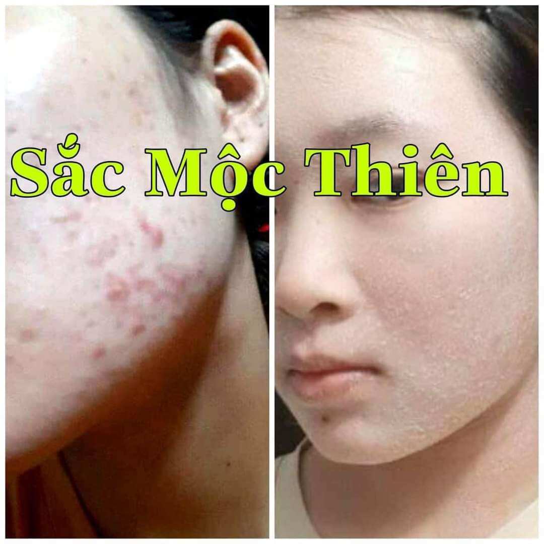 CHÍNH HÃNG Sắc Mộc Thiên Linh Chi Mộc