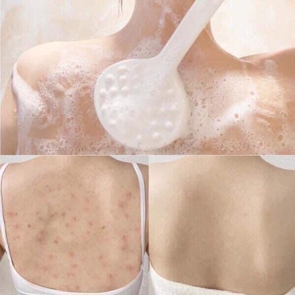 Sữa Tắm Sạch Mụn Lưng Some By Mi AHA-BHA-PHA 30 Days