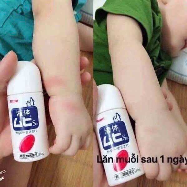 Lăn muỗi MUHI Nhật Bản 50ml giảm sưng, làm dịu da bé