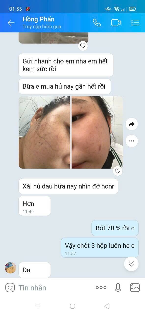 kem dưỡng trắng da.
